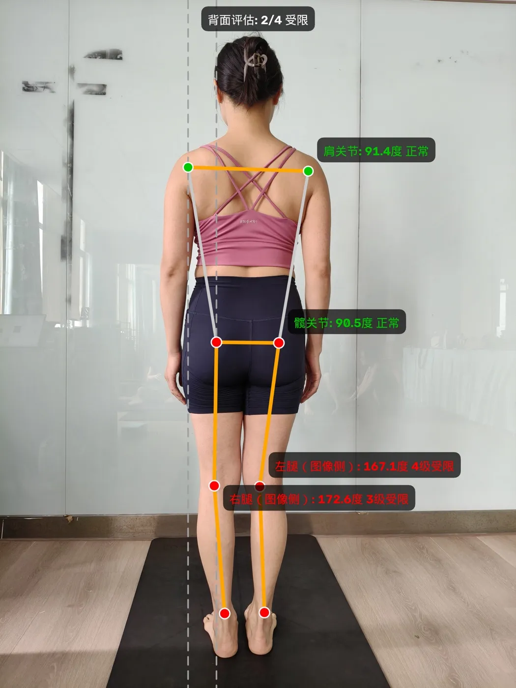 背面评估